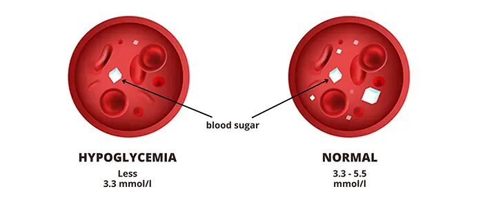 What Causes Low Blood Sugar Without Diabetes?